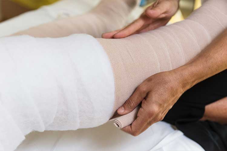 Living with Lipedema