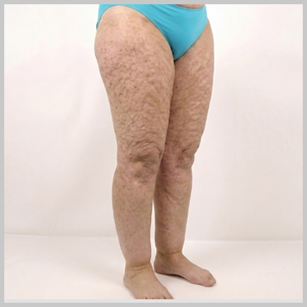 Legs - 3/4 Angle