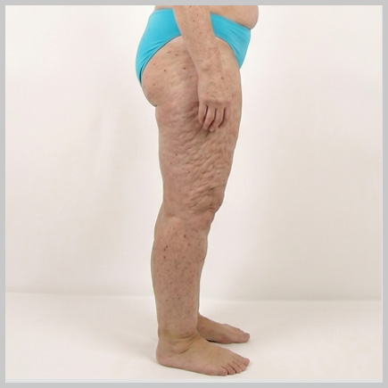 Legs - Side
